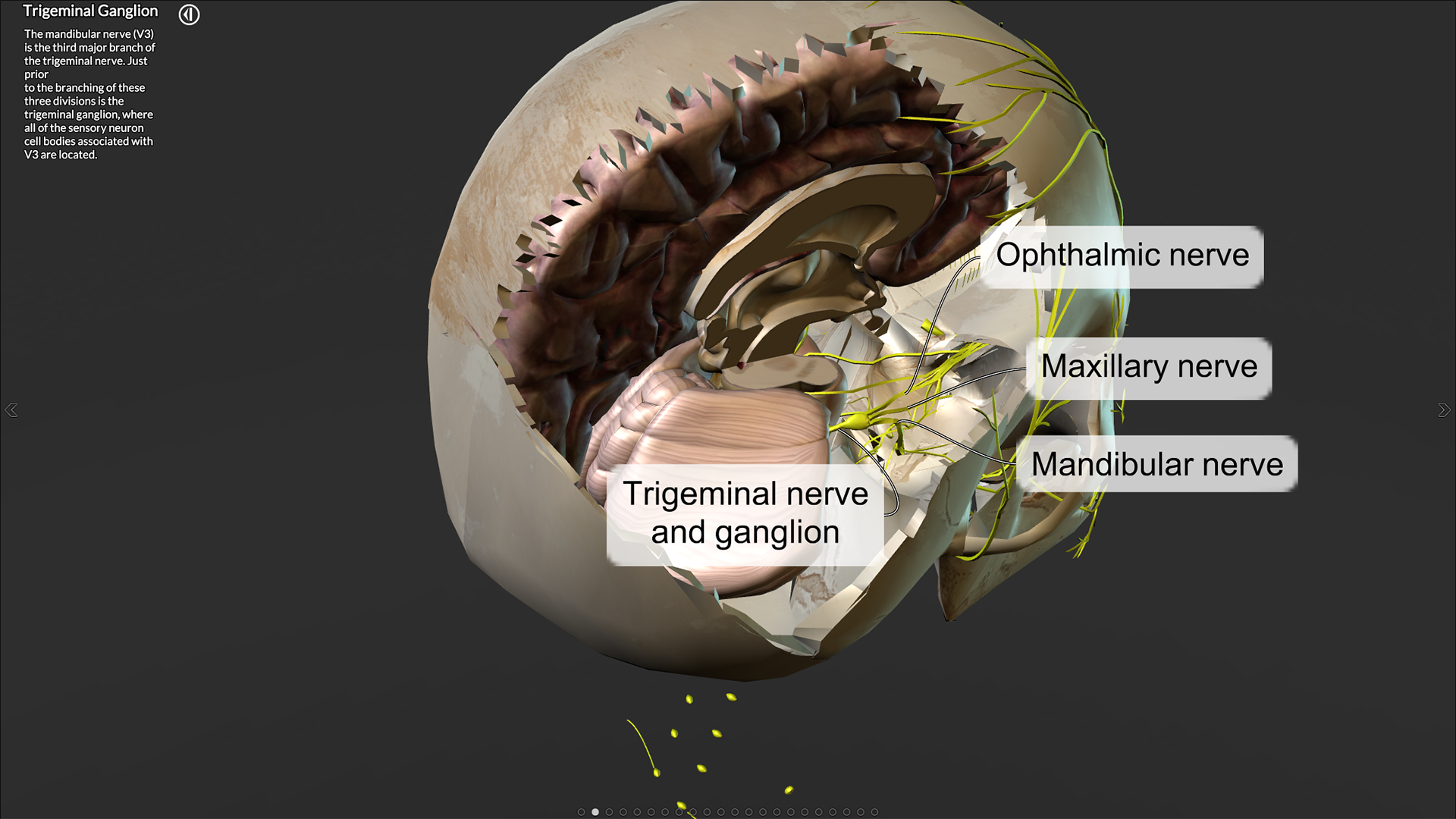 3D virtual dissection.