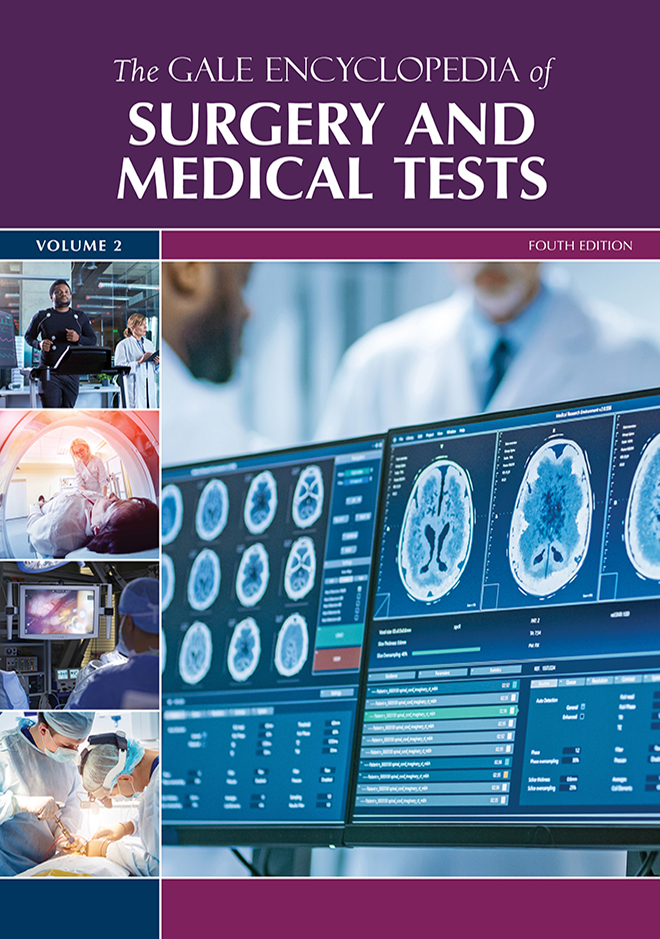 Encyclopedia of Surgery and Medical Tests